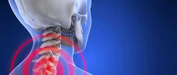 На что влияет остеохондроз шейного отдела позвоночника?